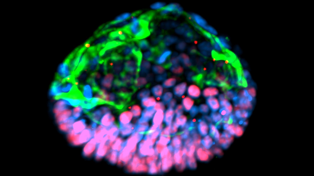 The PASE, or post-implantation amniotic sac embryoid, is a structure grown from human pluripotent stem cells that mimics many of the properties of the amniotic sac that forms soon after an embryo implants in the uterus wall. The structures could be used to study infertility. Credit: University of Michigan