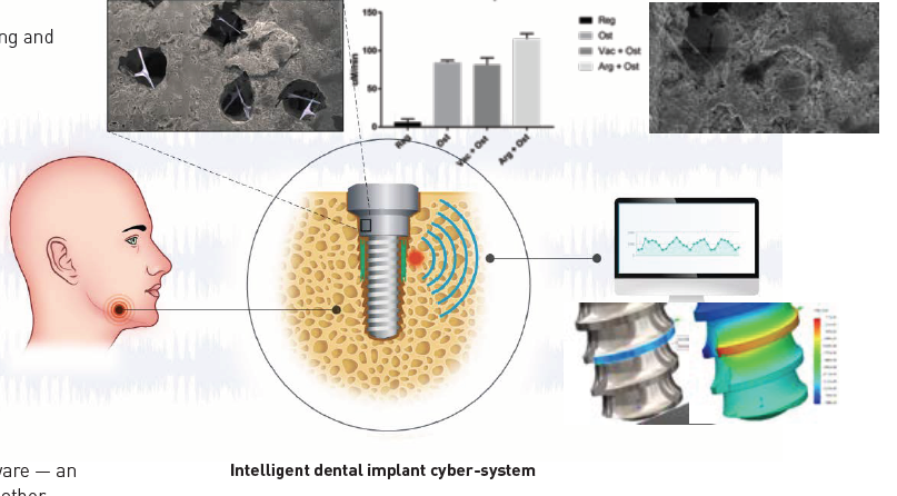 Intelligent dental implant cyber-system