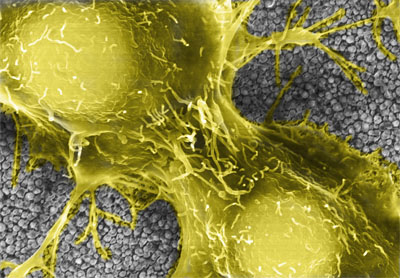 False color SEM images showing human embryonic stem cells adhered on the nanorough glass surface