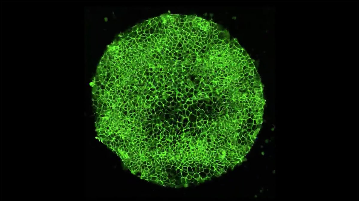 The cells are genetically modified with a molecule that glows green.
