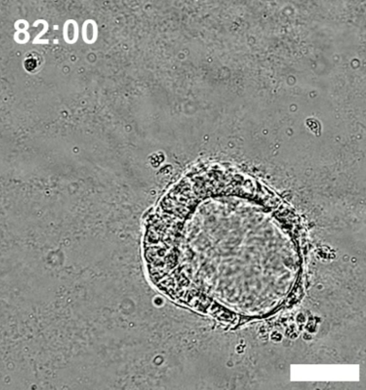 Stem cells self-organize in ways that mimic a human embryo.
