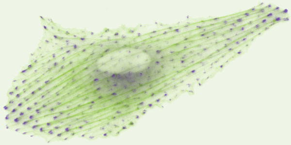 Live-cell imaging showing a single rat embryo fibroblast cell with individual focal adhesions (dotted structures) and the actin cytoskeleton (cable-like structures connecting individual focal adhesions)