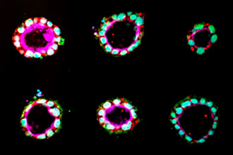 Microscopic results of cysts from a cell culture in the G.G. Brown Building. Photo: Joseph Xu